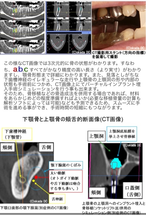 △01)拡大写真で見る ペリオとインプラントのための審美形成外科/Otto 